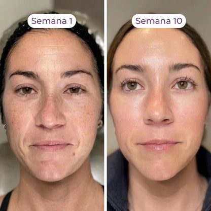 NMN Complejo Anti-Edad 10-en-1